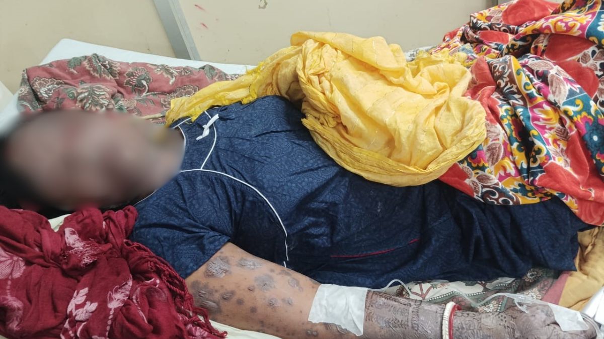 patna news duplicate mehndi spoils karwa chauth woman suffers poisoning