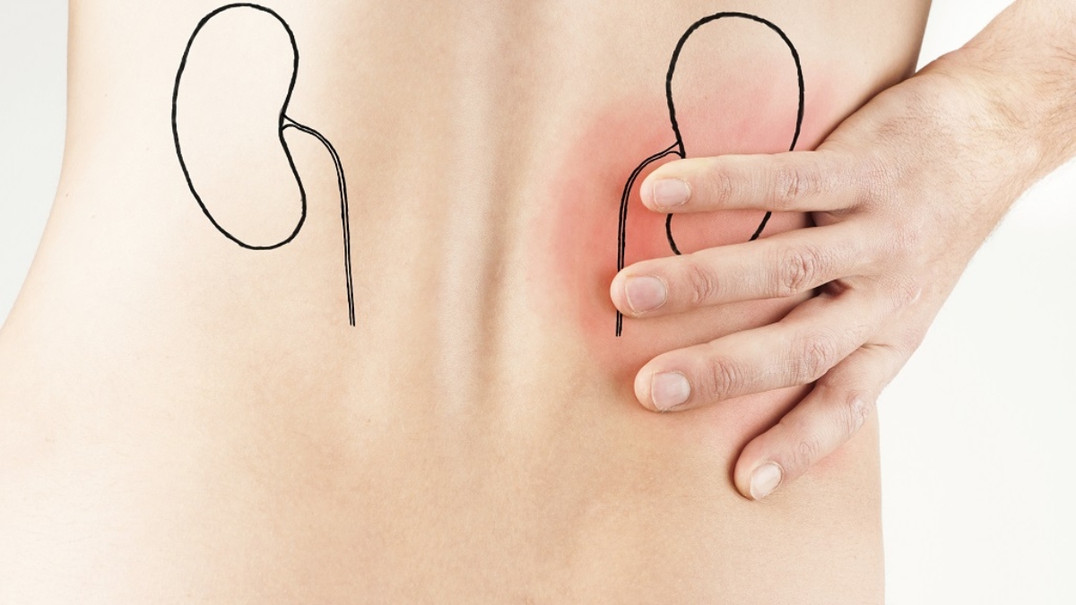 living healthy with one kidney expert advice and care tips