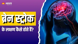 कैसे करें ब्रेन स्ट्रोक की तुरंत पहचान? (Picture Courtesy: Freepik)