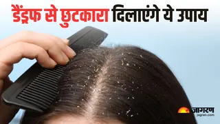 डैंड्रफ से राहत दिलाएंगे ये नेचुरल शैम्पू (Picture Courtesy: Freepik)