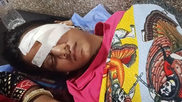 किशोरी पर फेंके पटाखे! आंखों में लगी गंभीर चोट, कुछ दिन पहले ही पड़ोसी से हुआ था विवाद
