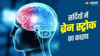 तापमान में बदलाव से बढ़ने लगे स्ट्रोक और ब्रेन हैमरेज के मरीज