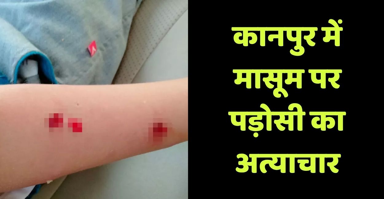 kanpur neighbor beats child and lets dog bite him over firecrackers