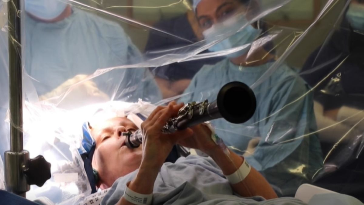 parkinsons patient plays clarinet during brain surgery viral video