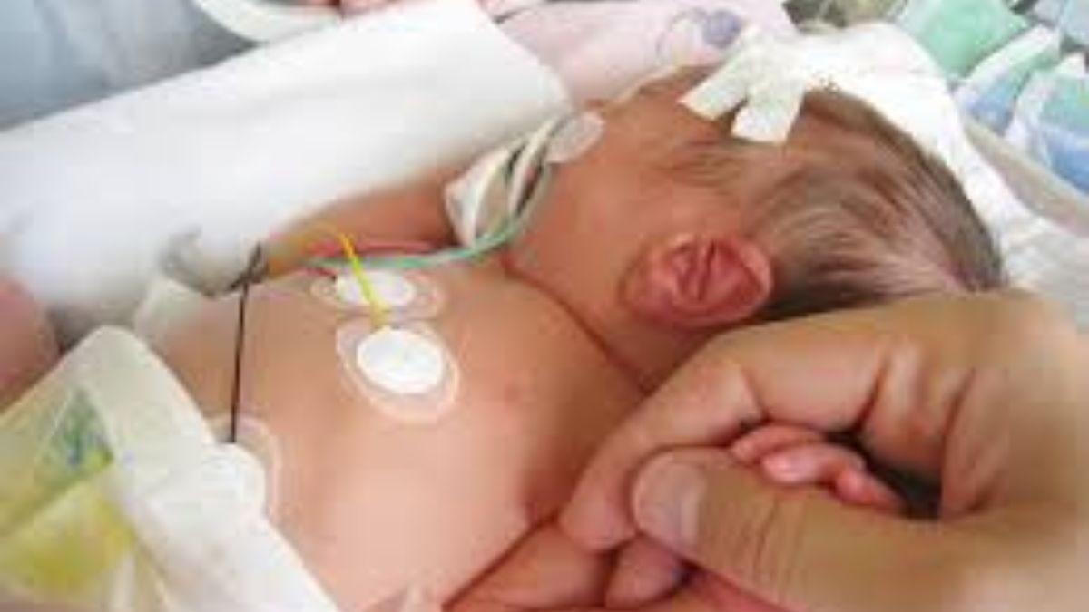 newborns hand amputated after wrong injection in noida