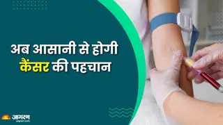 50 तरह के कैंसर का पता लगाने वाला ब्लड टेस्ट! (Picture Credit- Freepik)