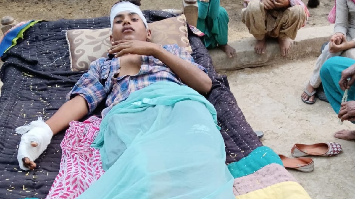 palwal student electrocuted teacher negligence leads to serious injury