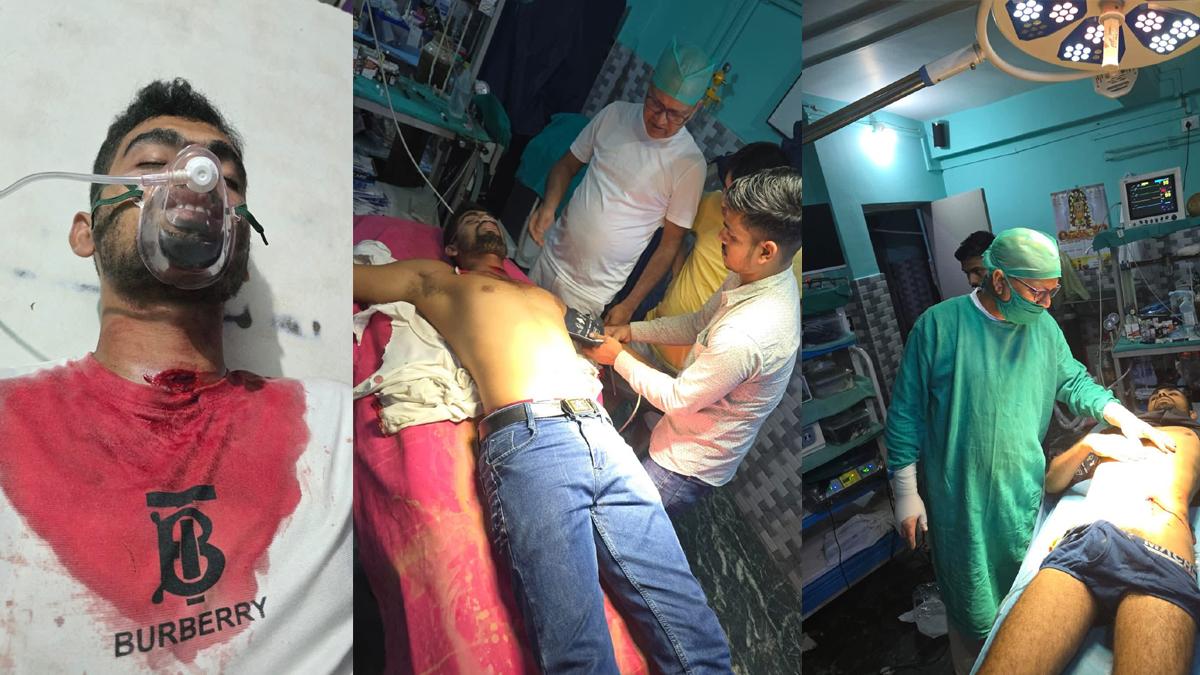 rohtas firing three injured during dugola program in karakat