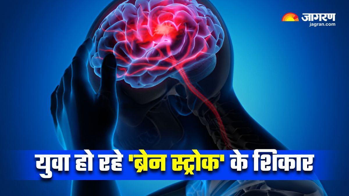 why is stroke hitting young adults 30s and 40s doctor explains lifestyle risk factors