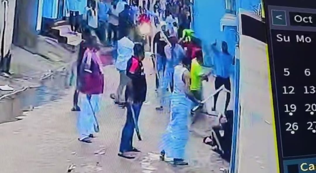 jamshedpur jmm leaders sons attacked with hockey sticks legs fractured