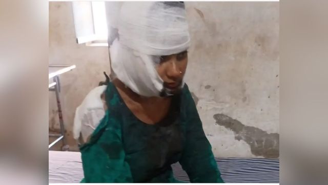 देवरिया में ई-रिक्शा की बैटरी चार्ज करने को लेकर मारा चाकू, तीन की हालत गंभीर
