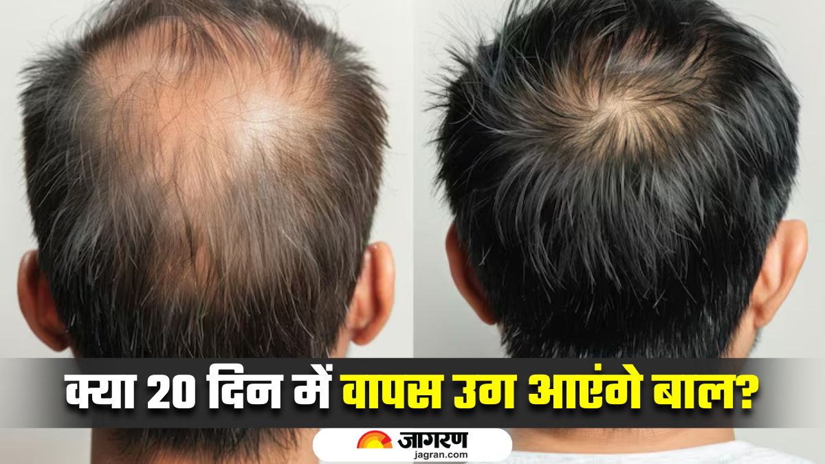 permanent baldness cure in 20 days scientists claim this serum grows new hair