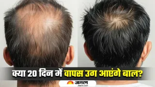 फैटी एसिड सीरम से 20 दिन में हेयर रीग्रोथ का दावा (Image Source: Freepik)