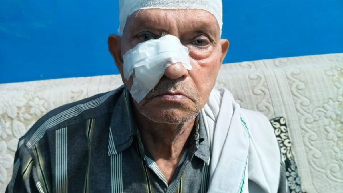 dog attack in chaubepur five injured in three days