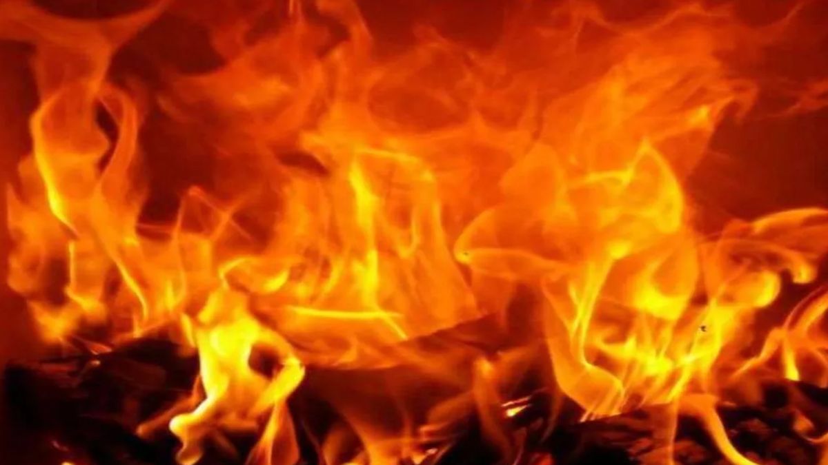 four children burnt in handwara fire referred for plastic surgery