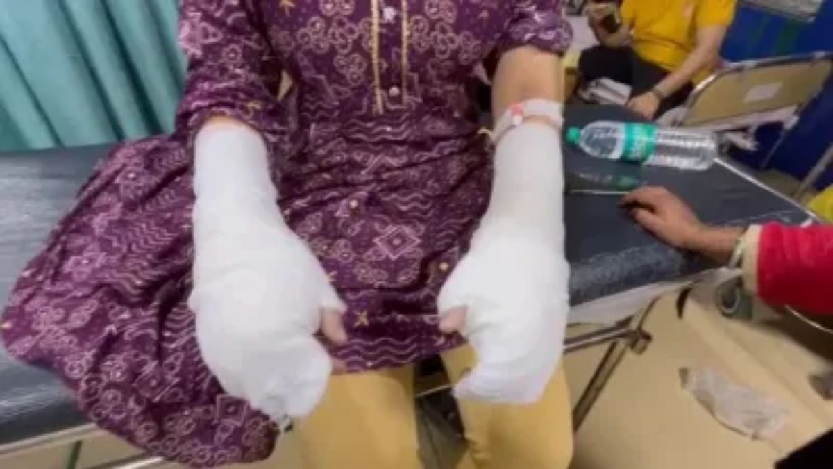 fake acid attack case busted in delhi students father arrested after brother and uncle read full story