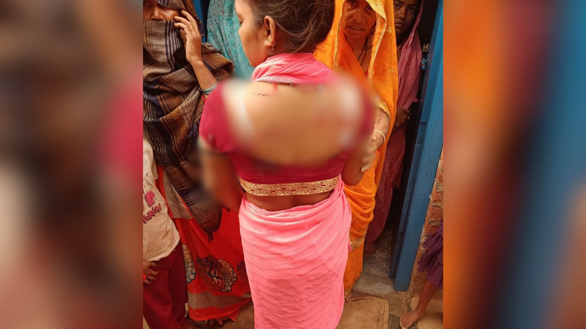 husband attacks wife with knife attempts suicide in firozabad