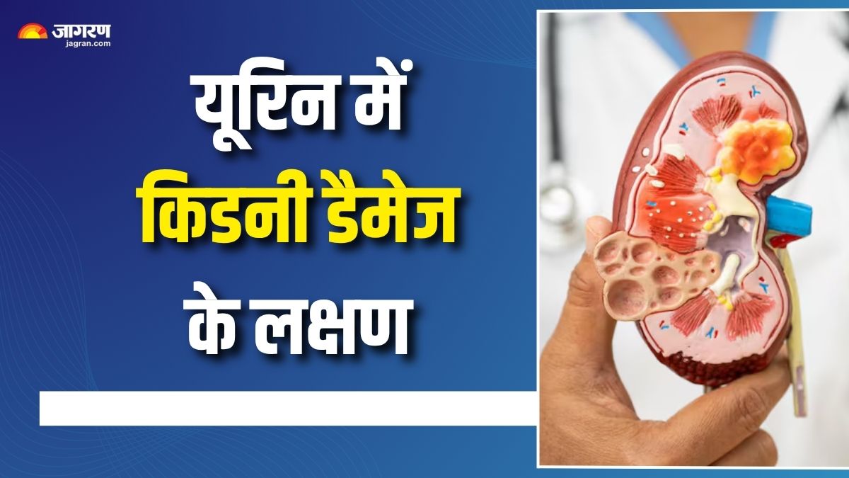 5 signs of kidney damage seen in urine check details here