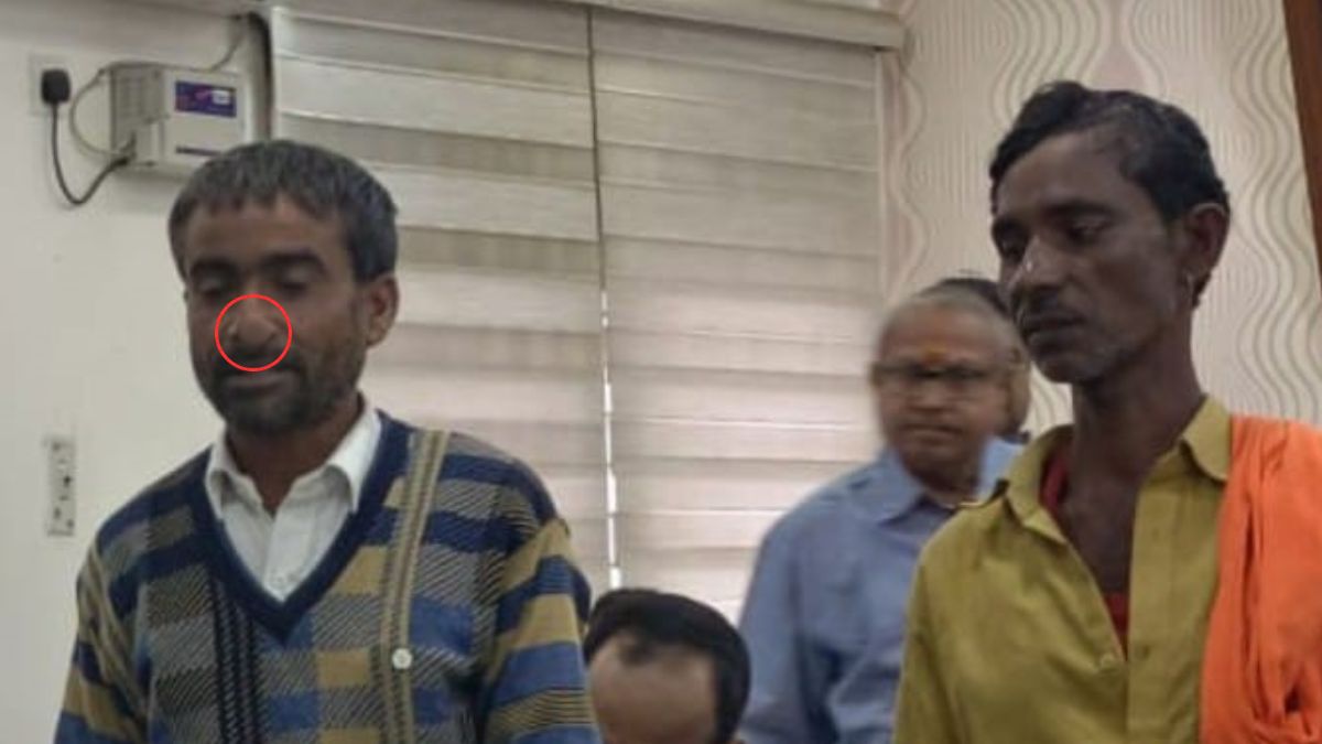 up district terrorized by nakkata bites fingers ears to save nose