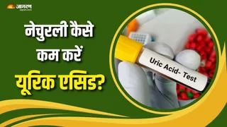 इन सब्जियों से नेचुरली कम होगा यूरिक एसिड (Picture Courtesy: Freepik)