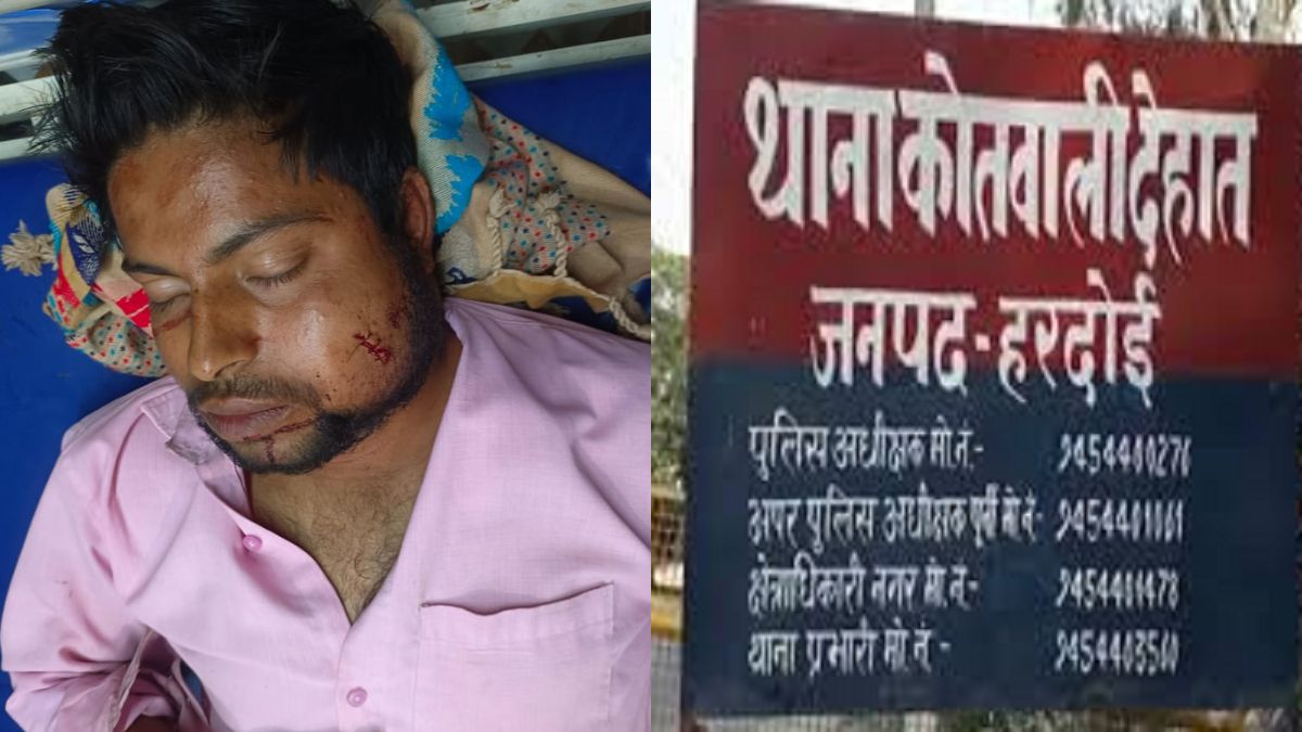 hardoi crime news shopkeeper attack from back in hardoi injured from fring