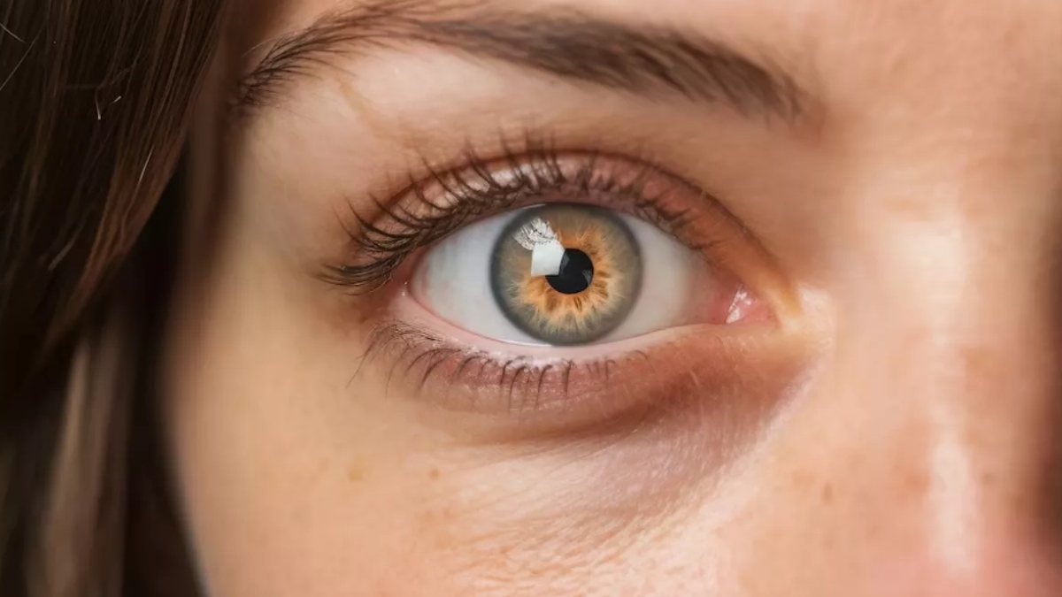 aipowered diabetic retinopathy screening now available at gims greater noida