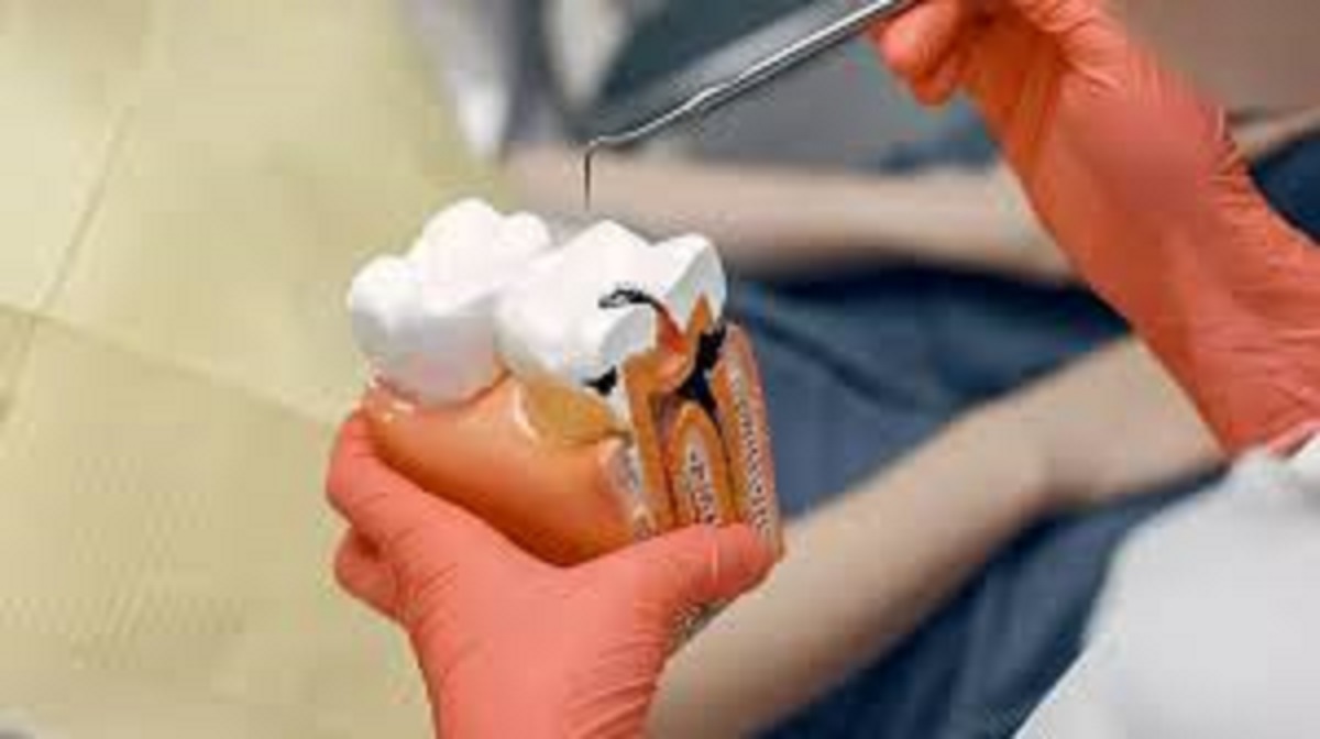 root canal treatment avoid haste for successful results