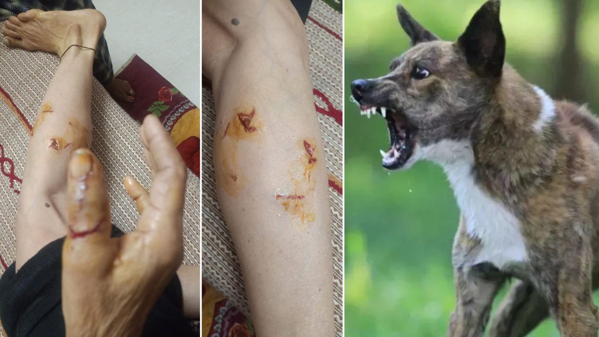 stray dog terror in sujanpur himachal 24 bitten in 2 hours