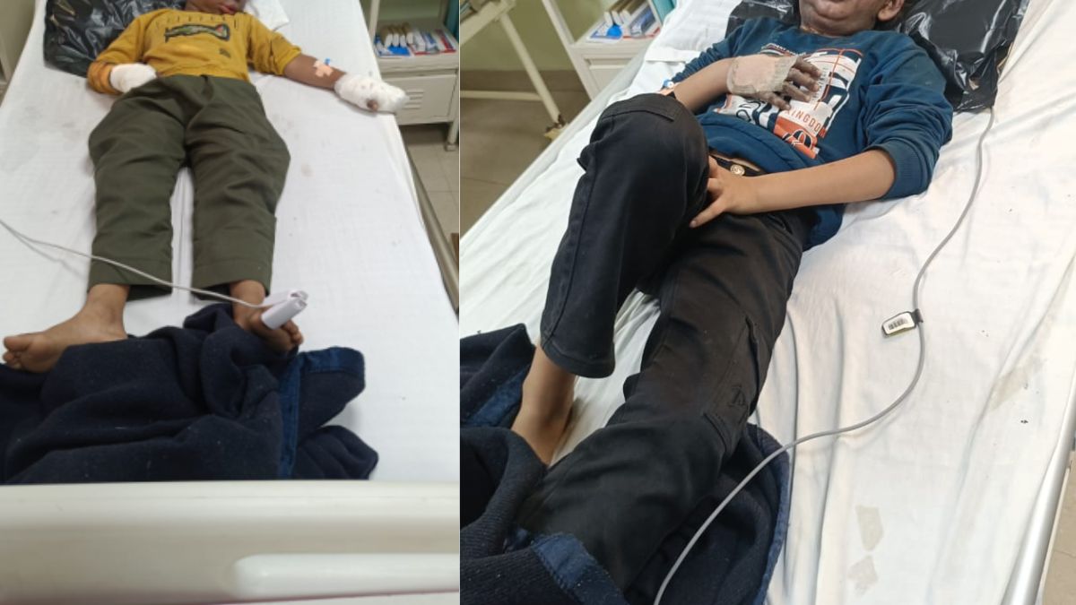 ghaziabad pizza oven explosion three injured in pratap vihar