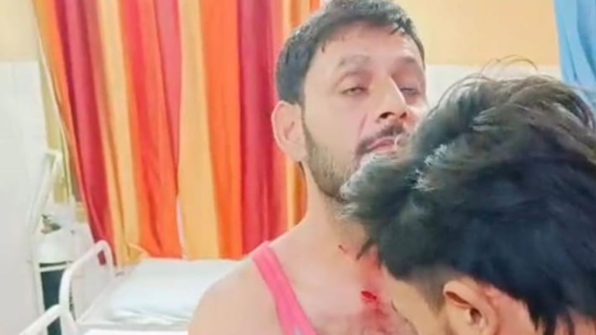 monkey attacks terrorize luhari village hapur