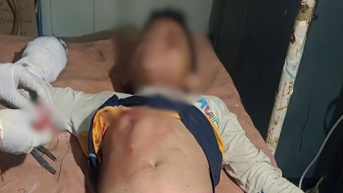 nainital three teenagers injured in barood bottle explosion