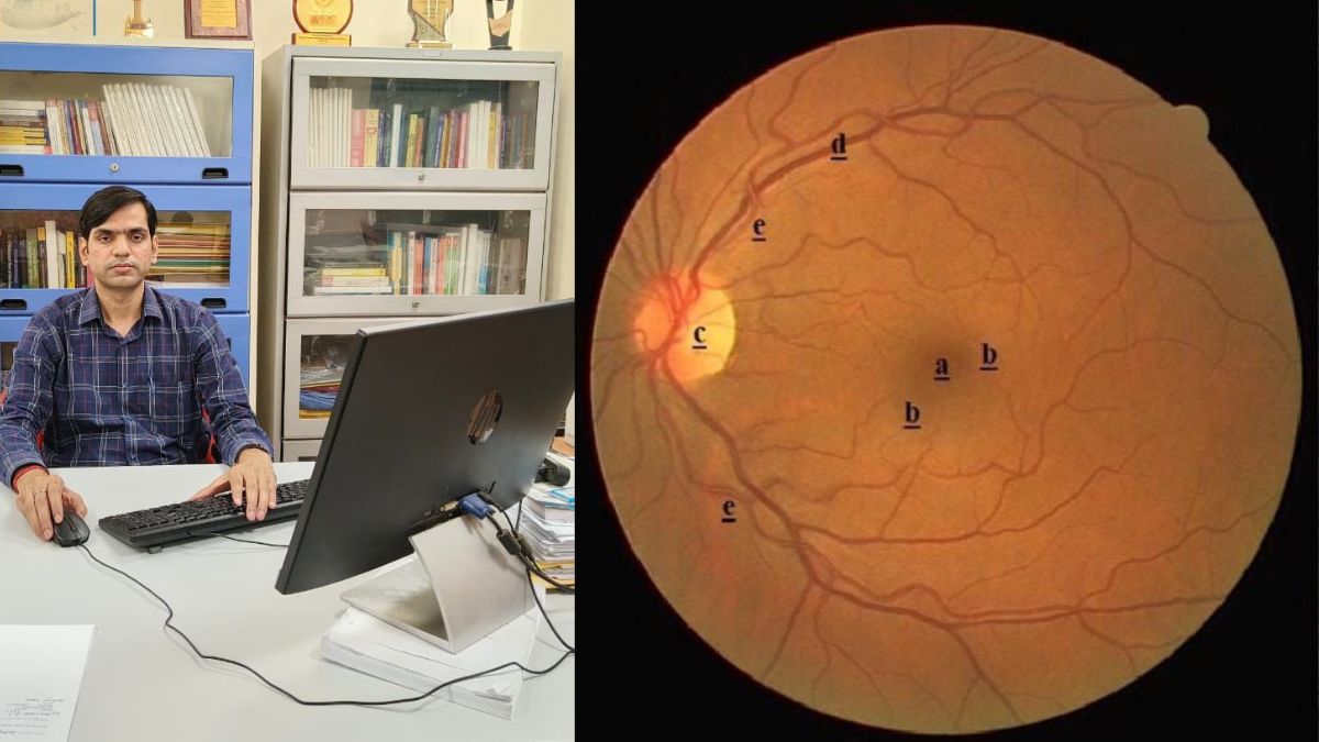 eyes will now reveal health reports retinal scans will detect hidden diseases