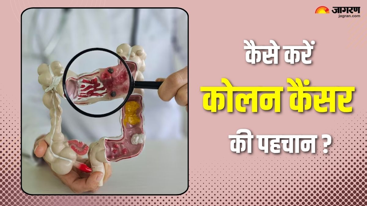 national cancer awareness day symptoms of colon cancer you should not ignore