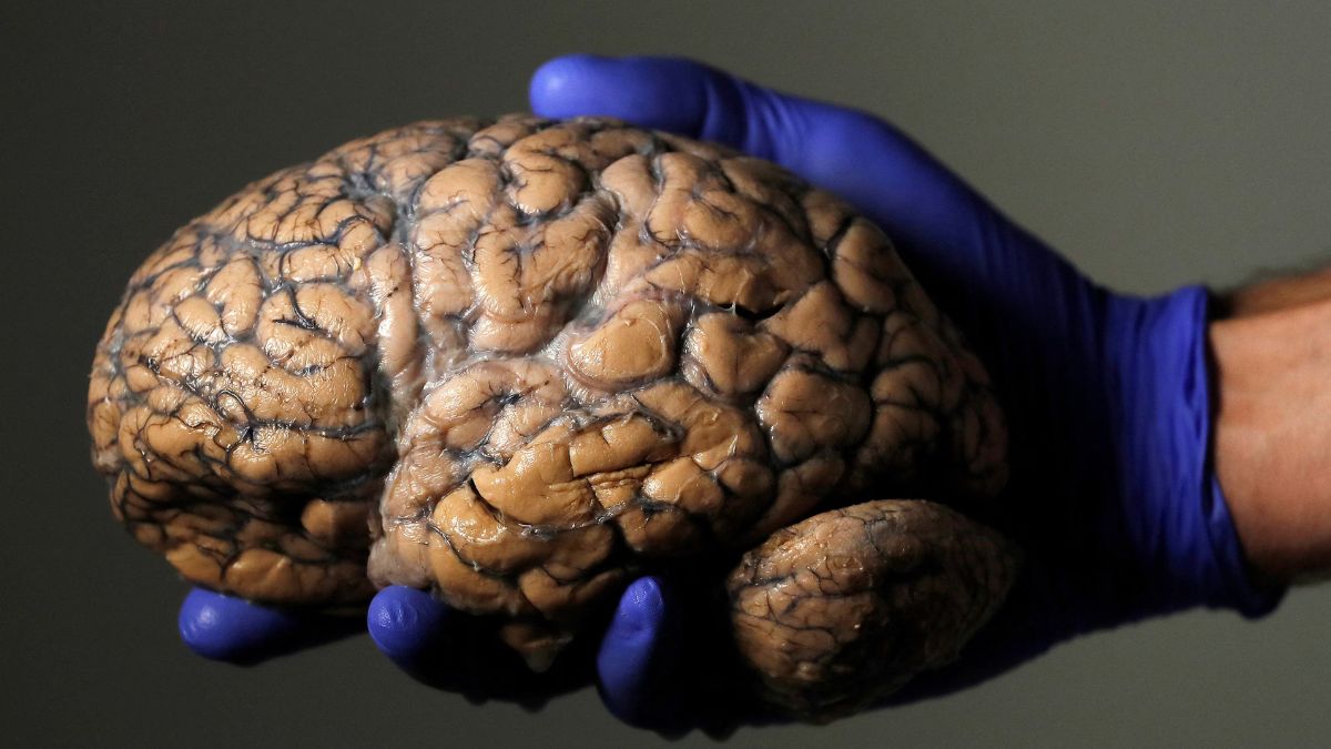 scientists release first draft of fetal brain atlas