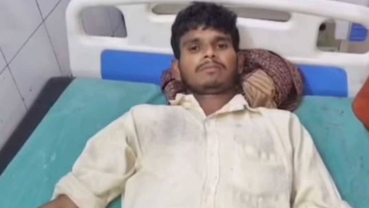 man bites cobras hood shocking incident baffles doctors