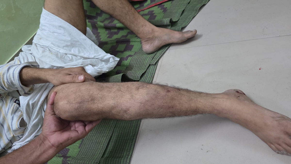 prayagraj 50k reward criminal jumps from building to evade police injured