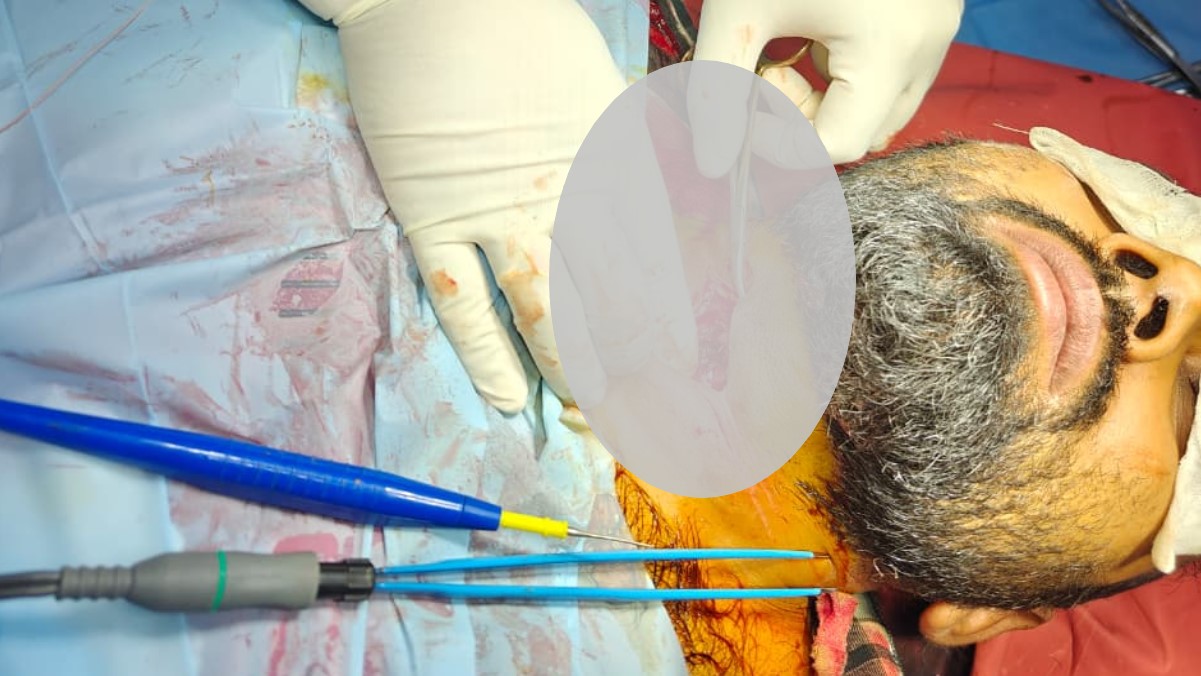 chinese manjha incident supervisor injured in varanasi