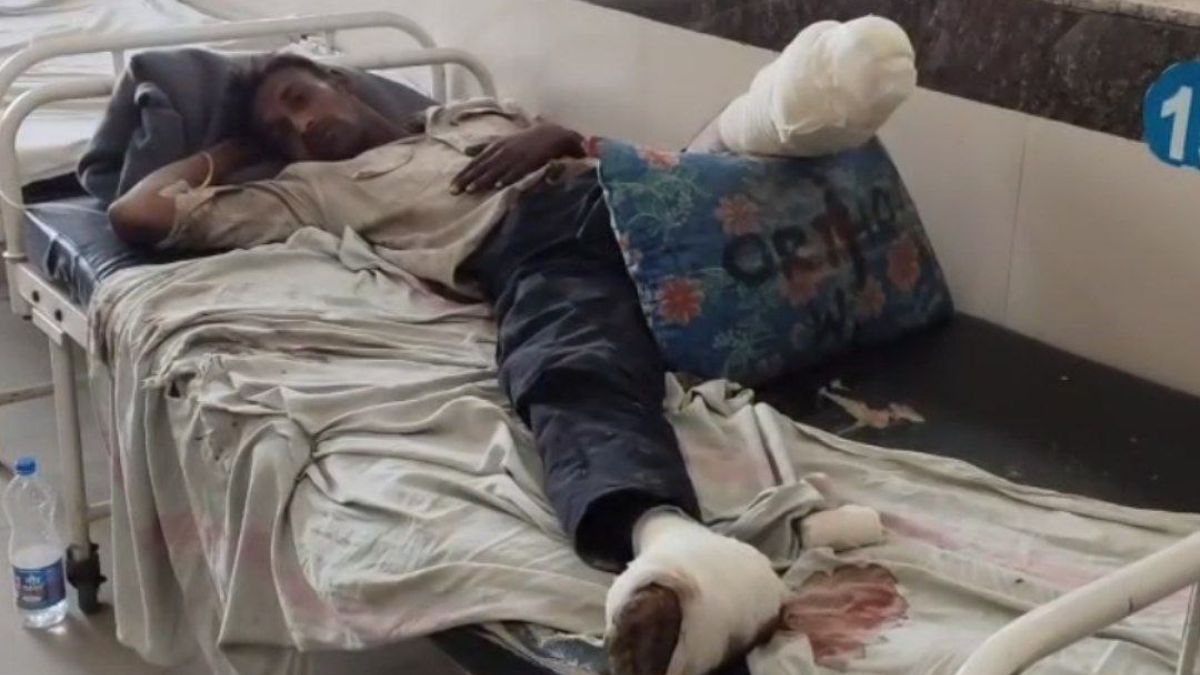 mp laborer loses leg after robbery near train tracks