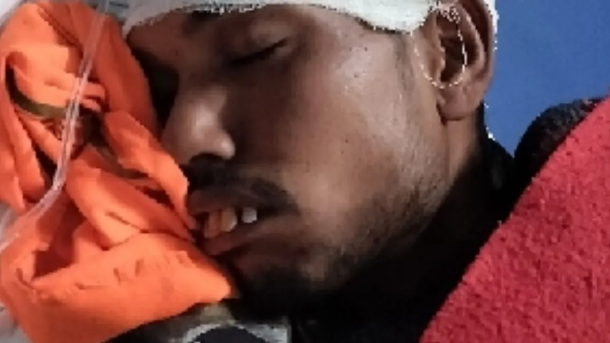 ऑटो को बचाने में चक्कर में पलटा डंपर, 4 लोग गंभीर रूप से घायल, हाईवे पर लगा डेढ़ किमी लंबा जाम
