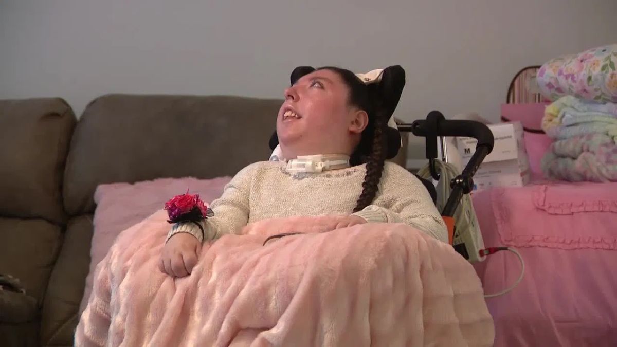 alex simpson defies odds celebrates 20th birthday despite rare brain condition