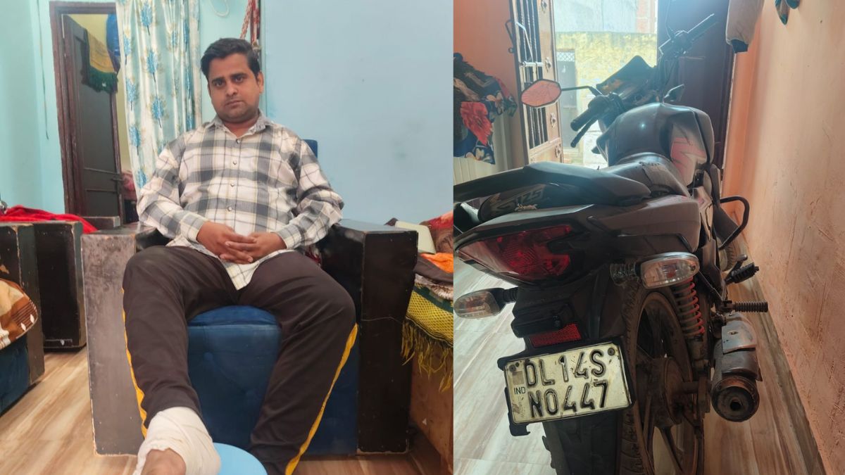 delhi blast injured man returns home to loni family relieved