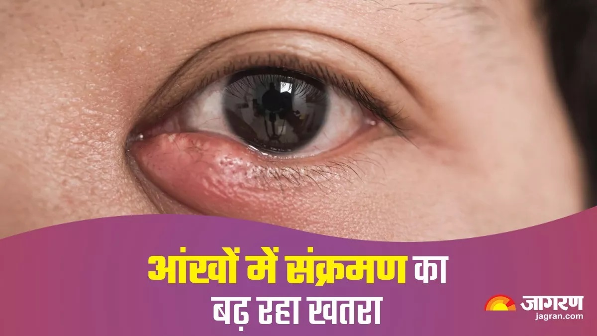 eye irritation rising pollution causes itching and pain in agra