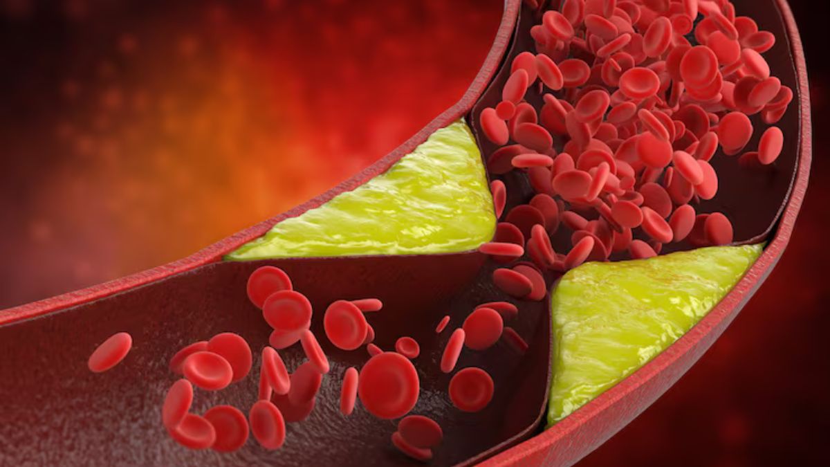 gene editing therapy reduces bad cholesterol and triglycerides by up to 50 percent check details here