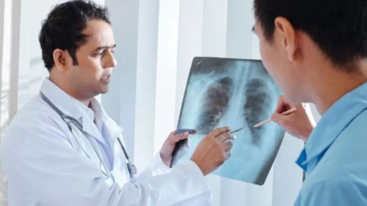 new tb cases have declined by 21 percent since 2015 says ministry of health