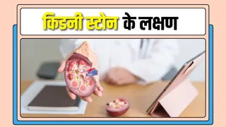 सर्दियों में किडनी स्टोन: कारण, लक्षण और बचाव के उपाय (Picture Credit- Canva)