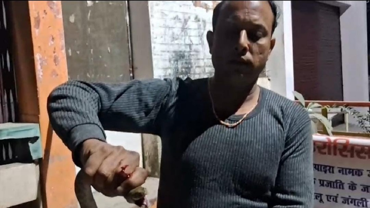 man bites snake youth carries biting snake to hospital for treatment