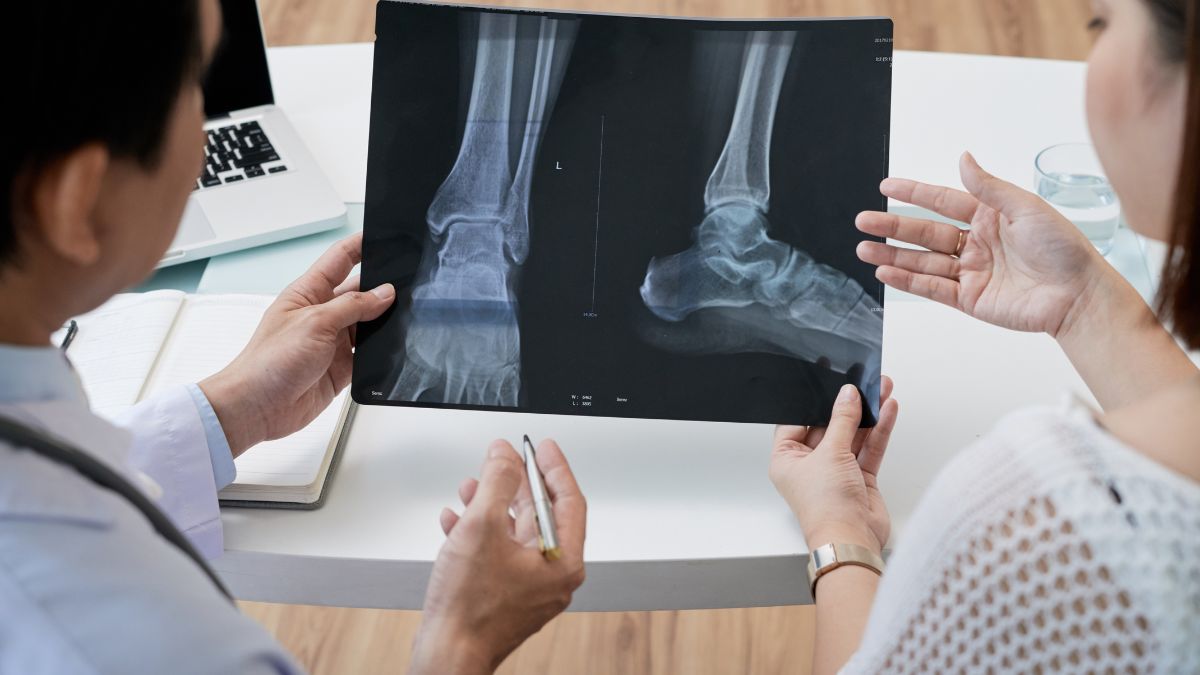 we43 bone fracture healing without steel plates nit researcher innovation