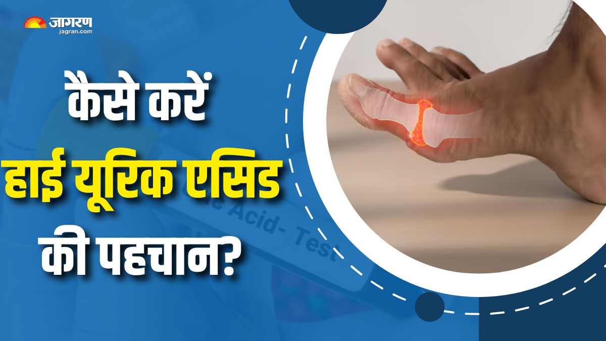 can high protein diet increase the level of uric acid and what are its symptoms check details here