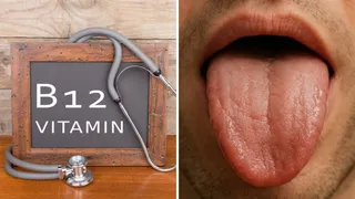 हल्के में न लें जीभ पर नजर आने वाले विटामिन-B12 की कमी के ये संकेत (Image Source: Freepik)