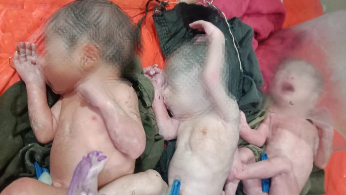 damoh woman gives birth to triplets premature babies under observation